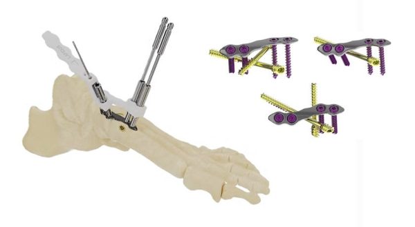 Forma Medical OptimalTMT