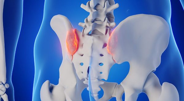 Aurora Spine Announces FDA 510(k) Clearance for the AERO Facet Fusion
