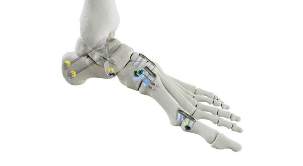 Medline REFLEX HYBRID