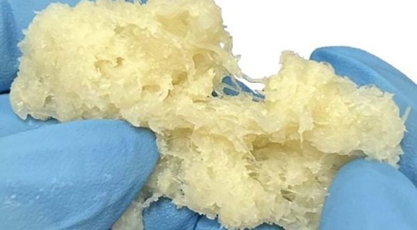 Xtant Medical Launches Trivium Advanced Bone Graft