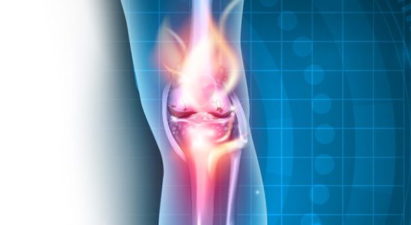 Doron Therapeutics Provides Update on MOTYS for Knee OA