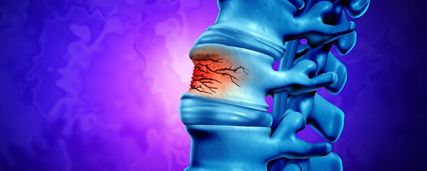 spine trends