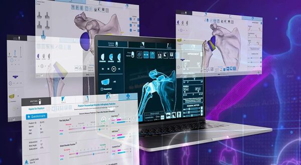 Exactech Shoulder Planning App