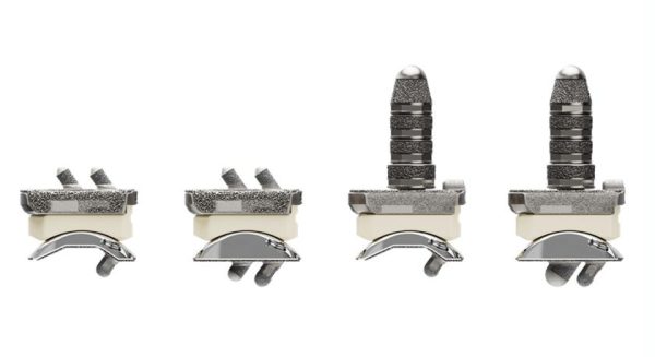 Stryker receives FDA clearance for Incompass Total Ankle