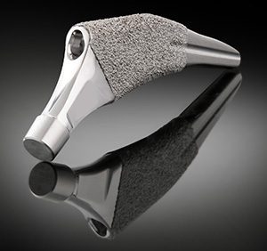 Exactech Alteon Short Tapered Wedge