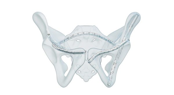 CurvaFix Low Profile System
