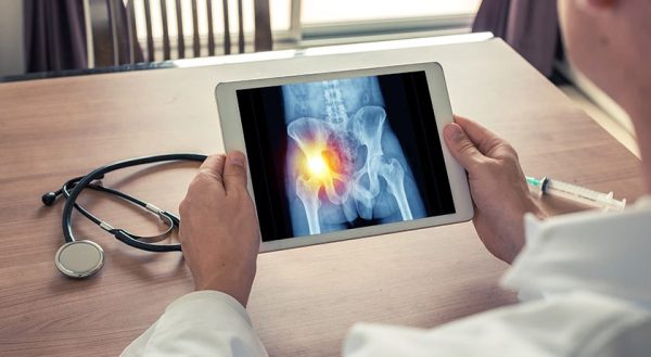 Zimmer Biomet Announces FDA Breakthrough Designation for World's First Iodine-Treated Total Hip Replacement System