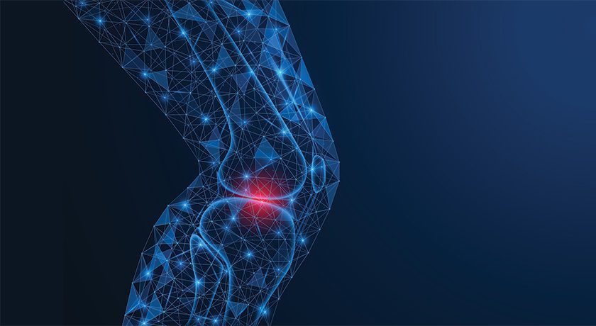 American Joint Replacement Registry Surpasses 4 Million Captured Hip and Knee Arthroplasty Procedures