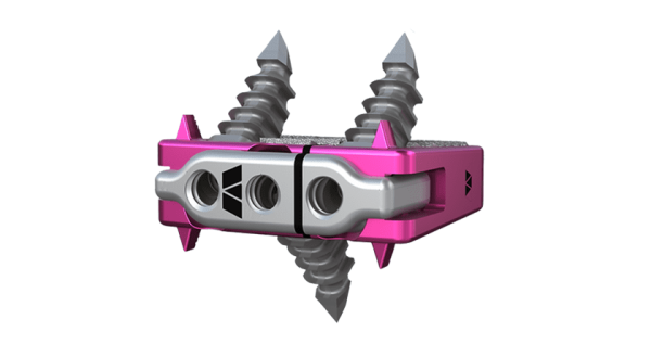 Elevation Spine Saber-C Spinal Fusion Implant