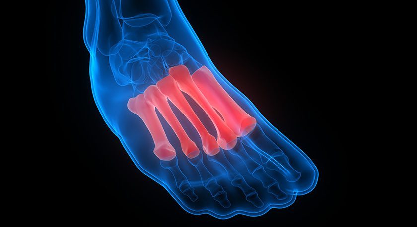 New US patent approval for Episurf Medical