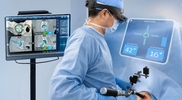Medacta NextAR Hip